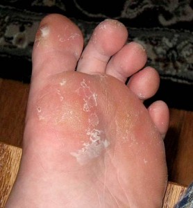 grossfoot