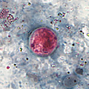 cyclospora_saf