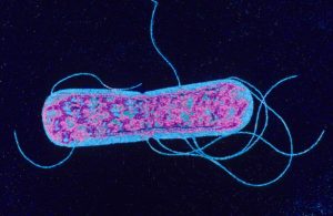 Salmonella typhimurium  Color Enhanced, TEM